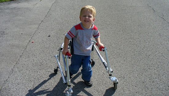 Locomotor Disability