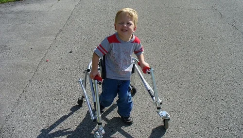 locomotor disability meaning