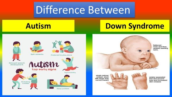 Difference between Autism and Down Syndrome Difference between Autism and Down Syndrome